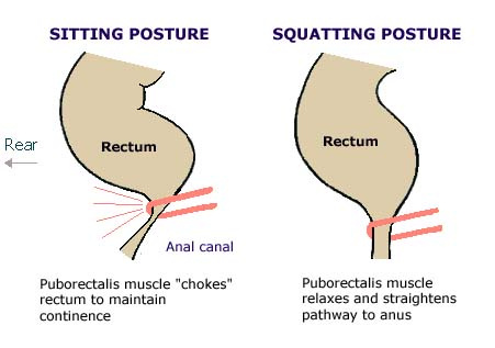 Colon Cancer – What Has Sitting Toilets Got To Do With It?