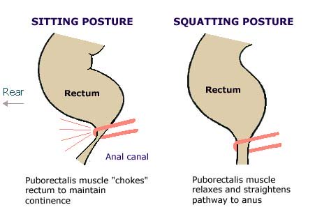 Sitting versus squatting, angle of anal canal in sitting and squatting positions